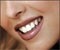 От улыбки станет всем светлей! Как отбелить зубы?